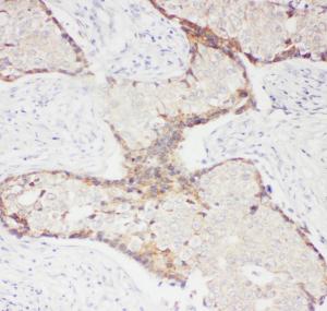 Anti-CD62P Rabbit Polyclonal Antibody