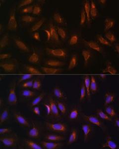 Immunofluorescence analysis of U-2 OS cells using Anti-NRBF2 Antibody (A9878) at a dilution of 1:100. DAPI was used to stain the cell nuclei (blue)