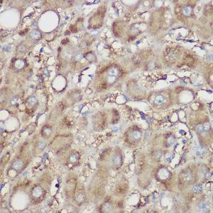 Immunohistochemistry analysis of paraffin-embedded human liver using Anti-NDUFB8 Antibody (A305426) at a dilution of 1:100 (40X lens). Perform high pressure antigen retrieval with 10 mM citrate buffer pH 6.0 before commencing with IHC staining protocol