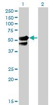 Anti-AAK1 Mouse Monoclonal Antibody [clone: 4B10]