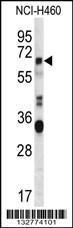 Anti-ERVFRD-1 Rabbit Polyclonal Antibody (APC (Allophycocyanin))