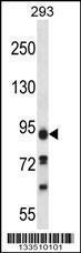 Anti-PALD1 Rabbit Polyclonal Antibody (Biotin)