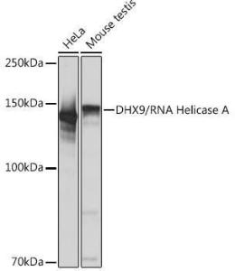 Western blot analysis of extracts of various cell lines, using Anti-RNA Helicase A Antibody [ARC1033] (A306342) at 1:1,000 dilution