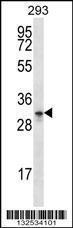 Anti-GPM6A Rabbit Polyclonal Antibody (HRP (Horseradish Peroxidase))