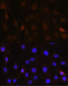 Immunofluorescence analysis of C6 cells using Anti-NRBF2 Antibody (A9878) at a dilution of 1:100 (40x lens). DAPI was used to stain the cell nuclei (blue)