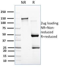 Anti-BAFF Mouse Monoclonal Antibody [clone: C257/1638]