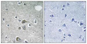 Immunohistochemical analysis of paraffin-embedded human brain tissue using Anti-FBLN2 Antibody. The right hand panel represents a negative control, where the antibody was pre-incubated with the immunising peptide.