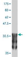 Anti-ANKRD17 Mouse Monoclonal Antibody [clone: 2B8]