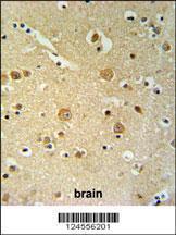 Anti-PKHH2 Rabbit Polyclonal Antibody (HRP (Horseradish Peroxidase))