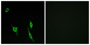 Immunofluorescence analysis of LOVO cells using Anti-DCC Antibody. The right hand panel represents a negative control, where the antibody was pre-incubated with the immunising peptide.