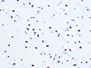 Immunohistochemistry analysis of paraffin-embedded rat brain using Anti-RNA Helicase A Antibody [ARC1033] (A306342) at a dilution of 1:100 (40X lens). Perform microwave antigen retrieval with 10 mM PBS buffer pH 7.2 before commencing with IHC staining protocol