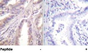 Anti-KIF11 Rabbit Polyclonal Antibody