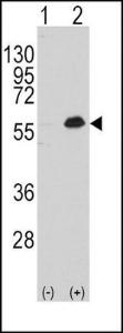 Anti-MEF2C Rabbit Polyclonal Antibody (AP (Alkaline Phosphatase))