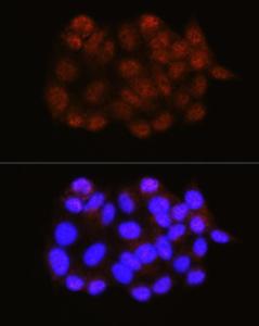 Immunofluorescence analysis of HeLa cells using Anti-NRBF2 Antibody (A9878) at a dilution of 1:100 (40x lens). DAPI was used to stain the cell nuclei (blue)