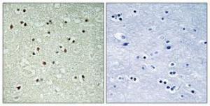 Immunohistochemical analysis of paraffin-embedded human brain using Anti-NCOA7 Antibody 1:100 (4°C overnight) The right hand panel represents a negative control, where the antibody was pre-incubated with the immunising peptide