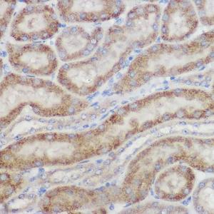 Immunohistochemistry analysis of paraffin-embedded mouse kidney using Anti-NDUFB8 Antibody (A305426) at a dilution of 1:100 (40X lens). Perform high pressure antigen retrieval with 10 mM citrate buffer pH 6.0 before commencing with IHC staining protocol