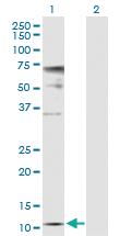 Anti-ZNRD1 Rabbit Polyclonal Antibody