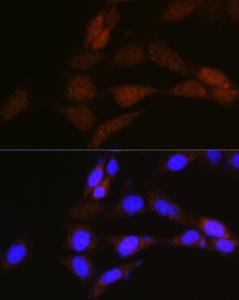 Immunofluorescence analysis of NIH-3T3 cells using Anti-NRBF2 Antibody (A9878) at a dilution of 1:100 (40x lens). DAPI was used to stain the cell nuclei (blue)