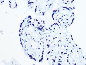 Immunohistochemistry analysis of paraffin-embedded human placenta using Anti-RNA Helicase A Antibody [ARC1033] (A306342) at a dilution of 1:100 (40X lens). Perform microwave antigen retrieval with 10 mM PBS buffer pH 7.2 before commencing with IHC staining protocol