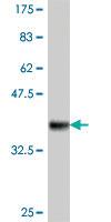 Anti-GATAD1 Mouse Polyclonal Antibody