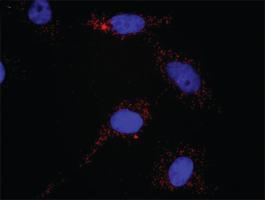 Anti-PDGFRB Antibody Pair