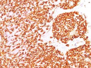 Anti-CD45 Mouse Recombinant Antibody [clone: rPTPRC/1460]