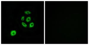 Immunofluorescence analysis of A549 cells using Anti-FBLN2 Antibody. The right hand panel represents a negative control, where the antibody was pre-incubated with the immunising peptide.