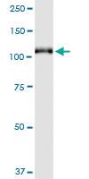 Anti-GRM6 Mouse Monoclonal Antibody [clone: 1A11]