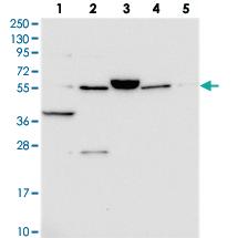 Anti-ACSM6 Rabbit Polyclonal Antibody