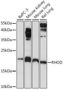 Anti-RHOD antibody