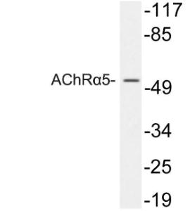 Western blot analysis of lysates from 293 cells using Anti-AChRalpha5 Antibody