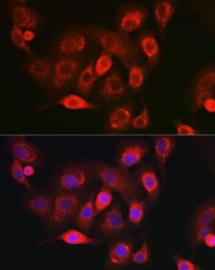 Immunofluorescence analysis of A-549 cells using Anti-NDUFB8 Antibody (A305426) at a dilution of 1:100 (40X lens). DAPI was used to stain the cell nuclei (blue)