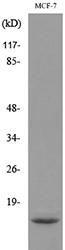 Western blot analysis of lysate from MCF7 cells using Anti-DBI Antibody