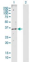 Anti-CAB39 Rabbit Polyclonal Antibody