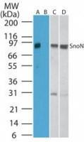 Anti-SKIL Rabbit Polyclonal Antibody