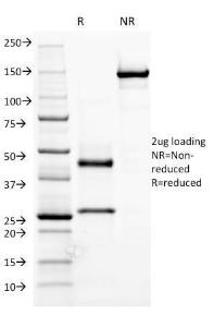 SDS-PAGE analysis of Anti-Human IgM Heavy Chain Antibody [R1/69] under non-reduced and reduced conditions; showing intact IgG and intact heavy and light chains, respectively. SDS-PAGE analysis confirms the integrity and purity of the antibody