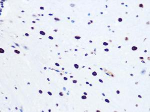 Immunohistochemistry analysis of paraffin-embedded mouse spinal cord using Anti-RNA Helicase A Antibody [ARC1033] (A306342) at a dilution of 1:100 (40X lens). Perform microwave antigen retrieval with 10 mM PBS buffer pH 7.2 before commencing with IHC staining protocol