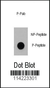 Anti-DNMT1 Rabbit Polyclonal Antibody