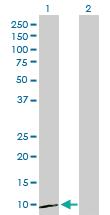 Anti-CXCL1 Rabbit Polyclonal Antibody