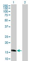 Anti-ZNF738 Mouse Polyclonal Antibody