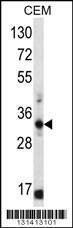 Anti-FFAR1 Rabbit Polyclonal Antibody (AP (Alkaline Phosphatase))