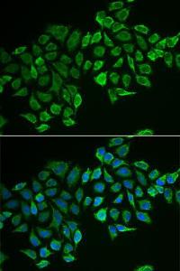 Anti-RHOD antibody