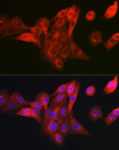 Immunofluorescence analysis of NIH/3T3 cells using Anti-NDUFB8 Antibody (A305426) at a dilution of 1:100 (40X lens). DAPI was used to stain the cell nuclei (blue)