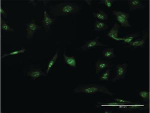 Anti-AAK1 Mouse Monoclonal Antibody [clone: 4B10]