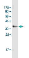 Anti-APOC3 Mouse Monoclonal Antibody [clone: 8H7]