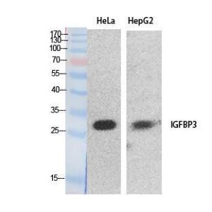 Western blot analysis of extracts from HeLa, HepG2 cells using Anti-IGFBP3 Antibody