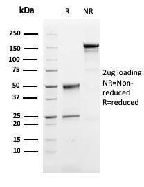 SDS-PAGE analysis of Anti-Perforin Antibody [PRF1/2468] under non-reduced and reduced conditions; showing intact IgG and intact heavy and light chains, respectively. SDS-PAGE analysis confirms the integrity and purity of the antibody.