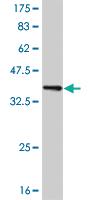 Anti-LDB1 Mouse Monoclonal Antibody [clone: 2G9]