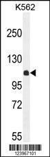 Anti-KIAA1324L Rabbit Polyclonal Antibody (AP (Alkaline Phosphatase))