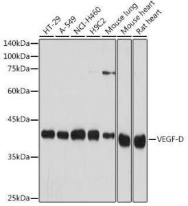 Western blot analysis of extracts of various cell lines, using Anti-VEGFD Antibody [ARC2402] (A309258) at 1:1,000 dilution